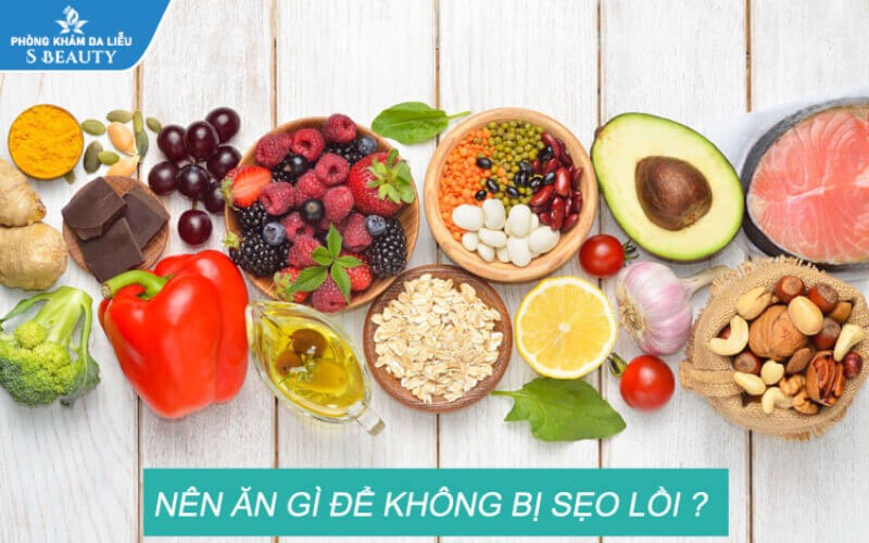 Bị sẹo rỗ