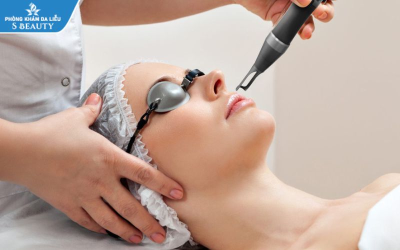 Bôi tế bào gốc sau laser