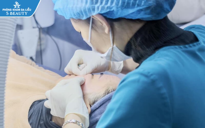 Đi nặn mụn xong nên làm gì