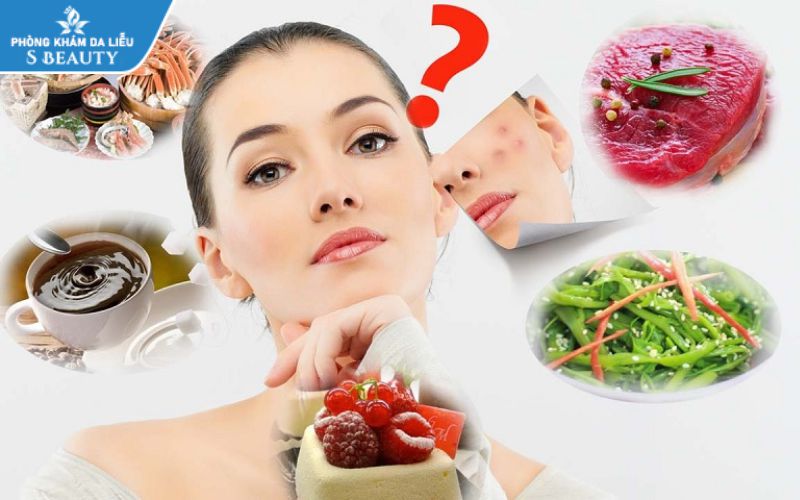 Nên ăn gì sau khi nặn mụn để da nhanh lành?