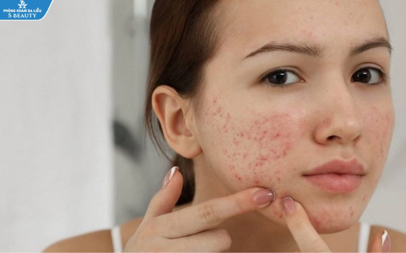 Các vết sẹo đỏ trên da