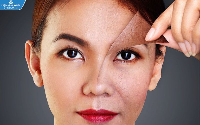 Tìm hiểu về tế bào gốc trong làm đẹp