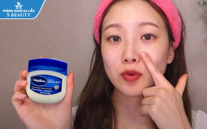 Trị mụn đầu đen bằng vaseline