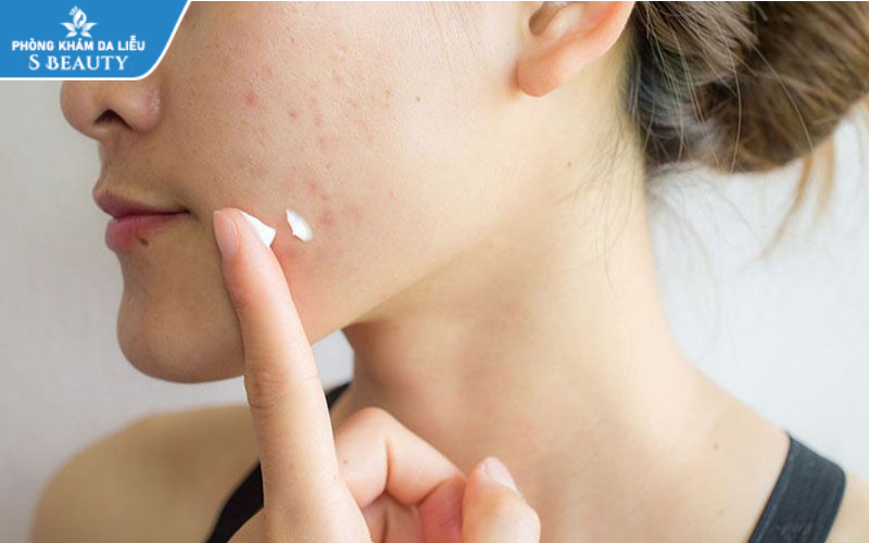 Megaduo kết hợp với Klenzit MS