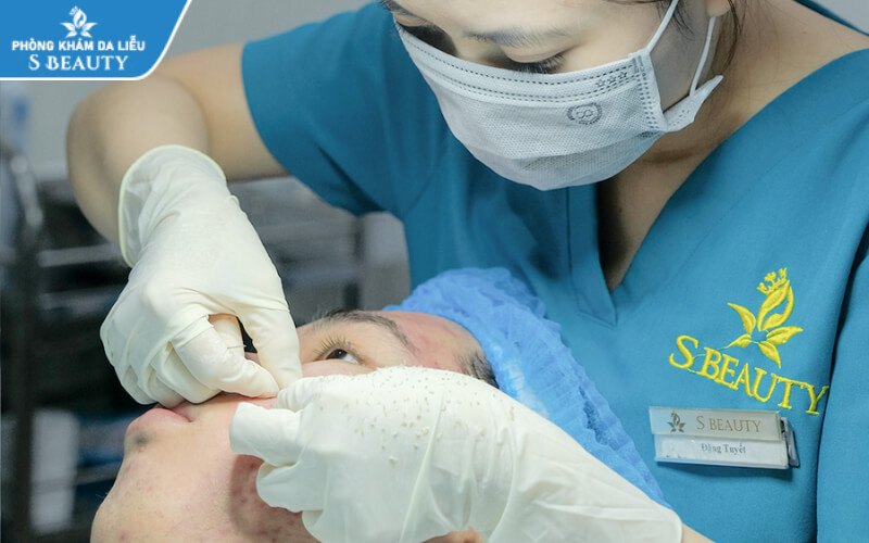 lấy nhân mụn có hết mụn không