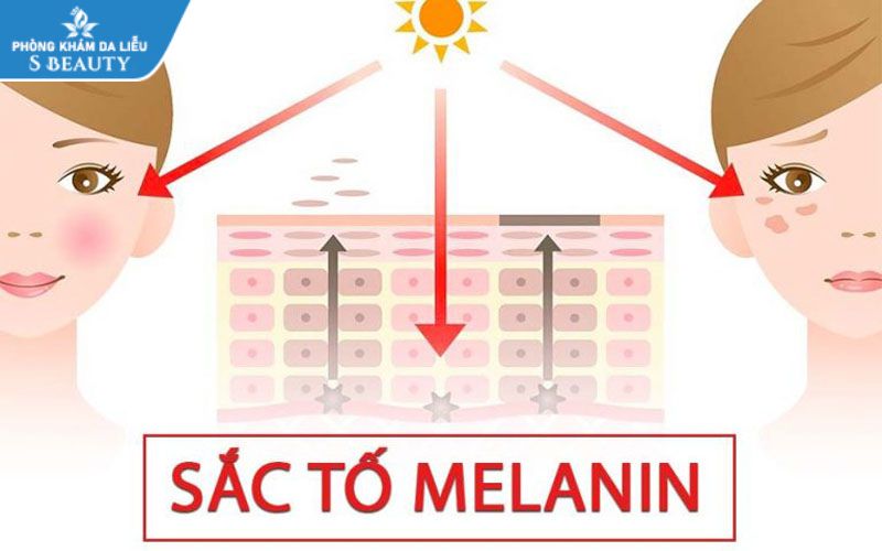 Sac-to-melanin-la-gi