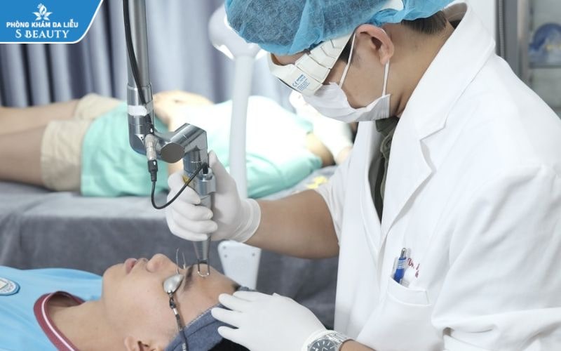 Triệt nám tàn nhang bằng laser