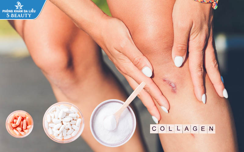 bi-seo-loi-co-nen-uong-collagen-khong