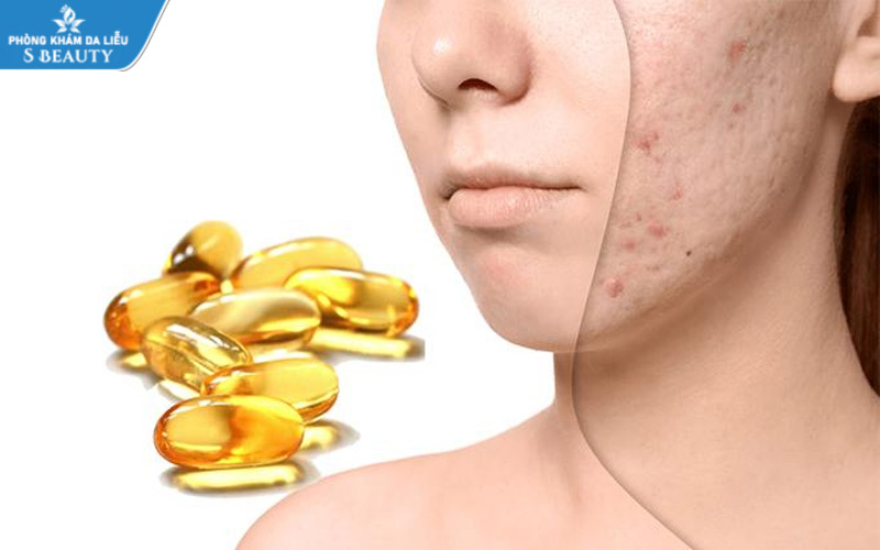 vitamin-e-co-tri-seo-ro-khong