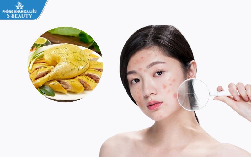 cach-nhan-biet-da-bi-nhiem-corticoid