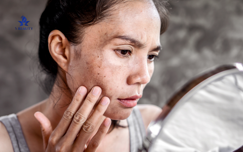 Ngăn Ngừa Biến Chứng Lâu Dài