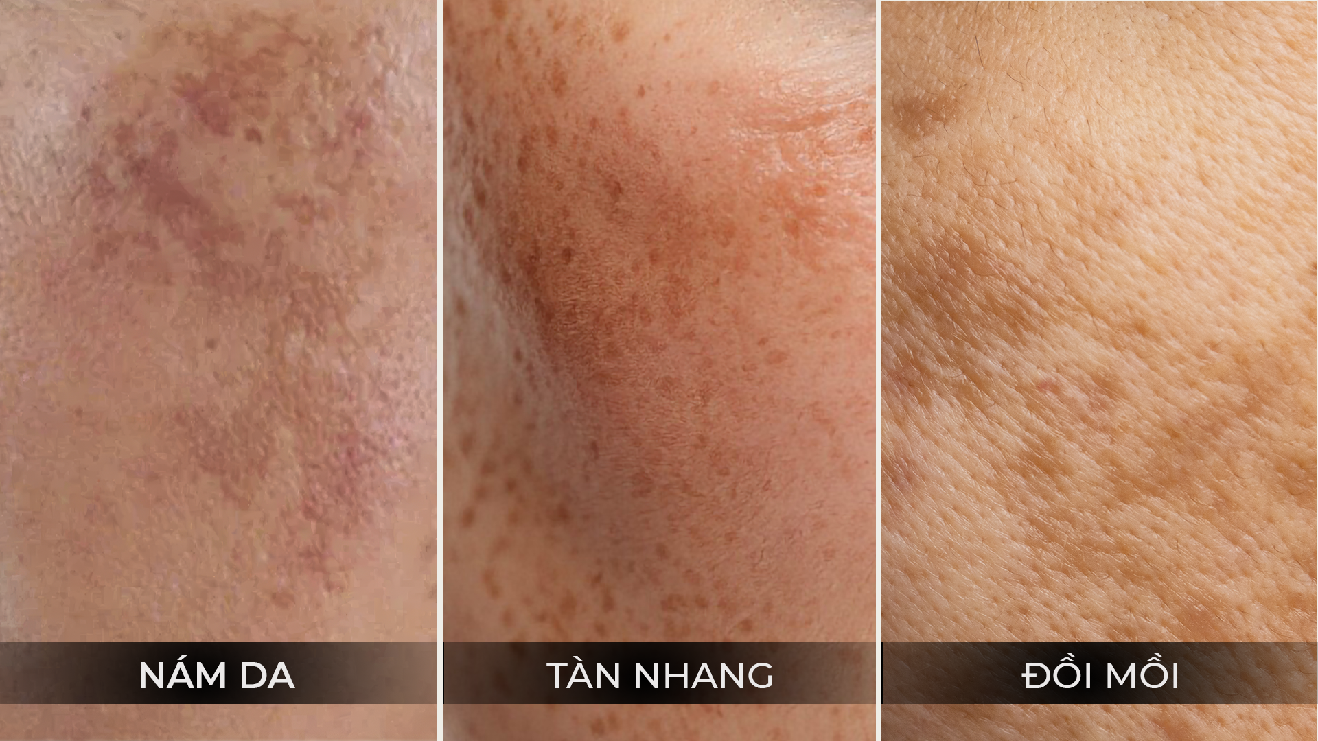 Các đốm nâu có thể trông giống nhau nhưng không phải cùng một bệnh sắc tố.