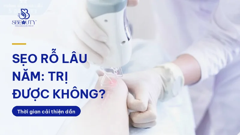 Nhân viên dùng laser điều trị sẹo rỗ lâu năm trên da tay khách