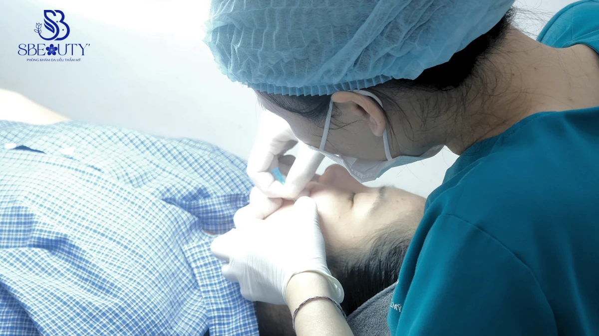 Bị mụn ẩn có nên đi nặn không? Cách trị mụn ẩn hiệu quả? — Phòng khám da liễu S Beauty Thủ Đức