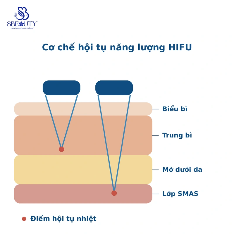 Sơ đồ cơ chế HIFU tác động lớp da sâu tại S Beauty Thủ Đức