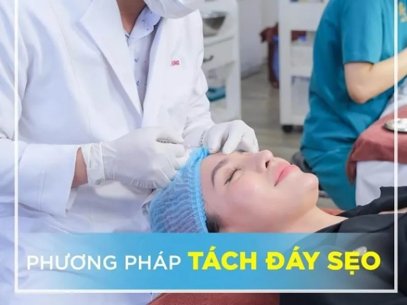 Bác sĩ áo trắng thực hiện tách đáy sẹo cho khách nữ nằm giường trong phòng điều trị